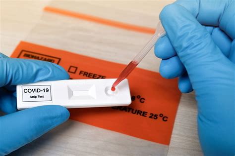 covid 19 test g枚teborg drop in|PCR and antigen test for Covid.